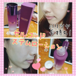 【セルコードステムローション】＠birthbank_official#バースバンク さんの話題の幹細胞コスメ°˖✧◝(⁰▿⁰)◜✧˖°✨✨へその緒の血管から培養されたヒト臍…のInstagram画像