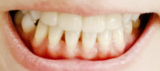 口コミ：歯の黄ばみ撃退にオススメの薬用ホワイトニング　デンタブラッシュEXの画像（2枚目）