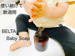 ベルタベビーソープ愛用中♡ミルクで洗うベルタベビーソープ☺️敏感な赤ちゃんの肌を、洗いすぎず、乾燥させず、洗い上がりしっとりのミルクタイプのベビーソープ👶💗顔洗っていても垂れてこないのは嬉…のInstagram画像