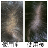 1本使用後の髪、地肌の変化