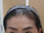 みきぽん日記（ https://ameblo.jp/mikipon0125/entry-12855362785.html ）女性専用育毛剤の長期モニターに参加☆産毛のような髪が普通の太さくらいの髪にな…のInstagram画像