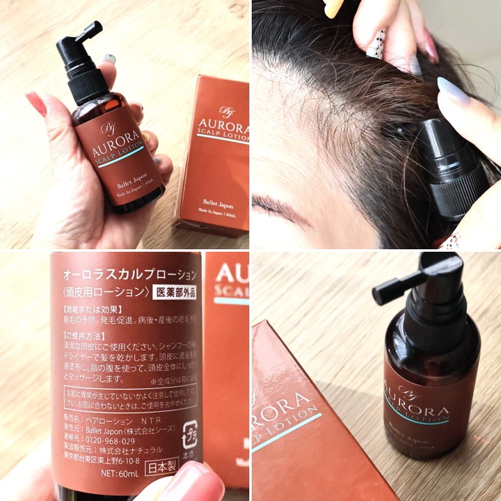 口コミ投稿：抜け毛・薄毛にダイレクトにスプレー！後退した生え際に期待♪.#PR #株式会社シーズ #…