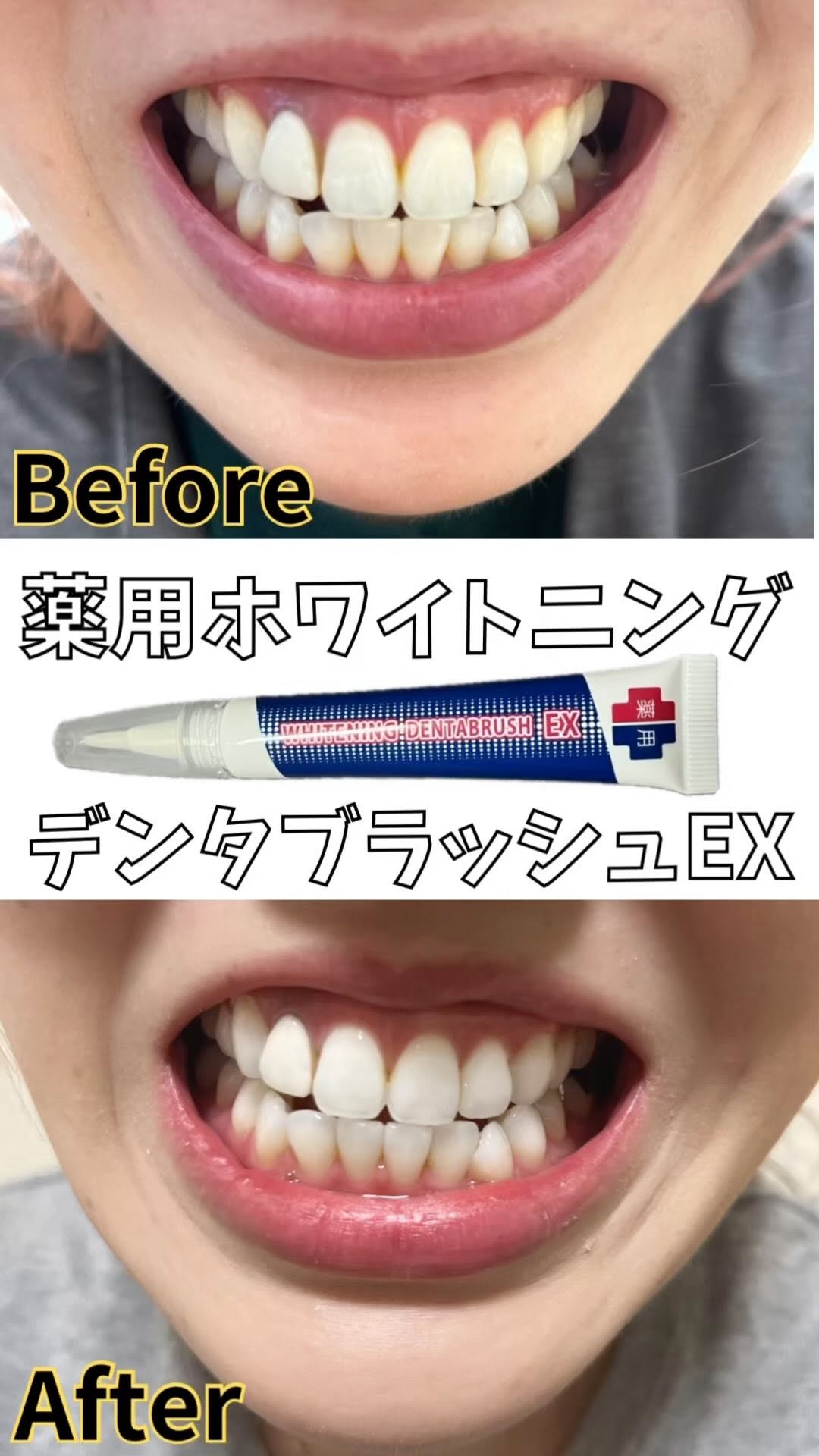 口コミ投稿：手軽だから毎日継続できる、歯の美白ケア。口元は意外とみられてます。私は歯のケア…