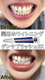 手軽だから毎日継続できる、歯の美白ケア。口元は意外とみられてます。私は歯のケアは毎日は歯磨き、デンタルフロス程度。年2回歯科検診に行ってます。コーヒーを毎日飲む習慣があるため、歯の色がくすみがち…のInstagram画像
