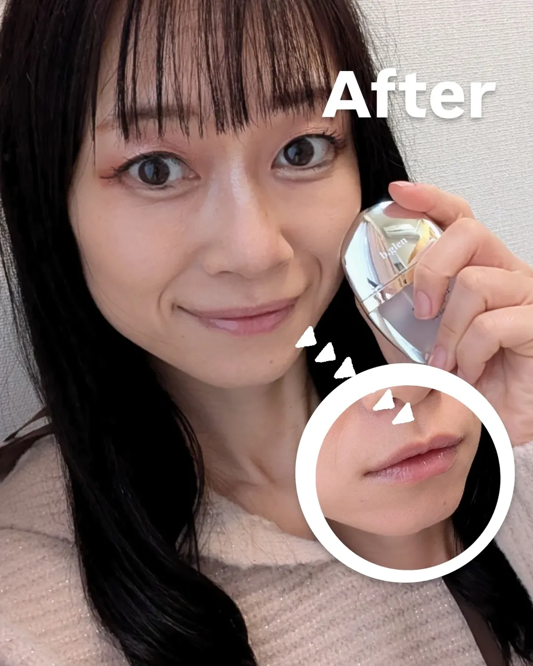 口コミ投稿：わかりやすいように無加工ドアップで撮ったので恥ずかしいんですが、、リップケアの…