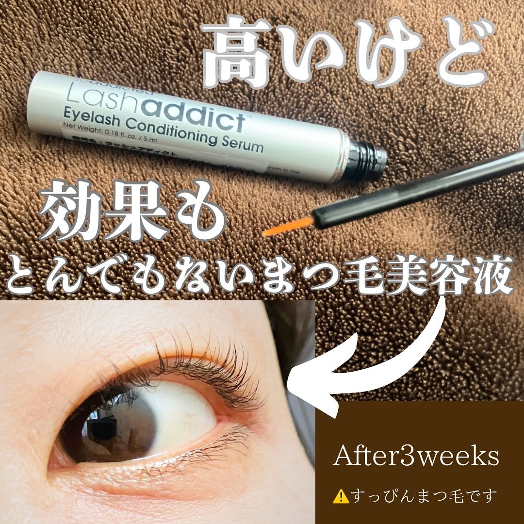 口コミ投稿：マツパを毎月かけ始めてから同時にスタートした#まつ育 活動まつ毛も元気でないとマ…
