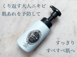 .【ロゼット洗顔サボン アクネウォッシュ】＼未体験の泡もち＆弾力／ニキビすっきりクリア！くり返す大人ニキビ・肌あれを予防して、すっきりすべすべ肌へ----------------…のInstagram画像