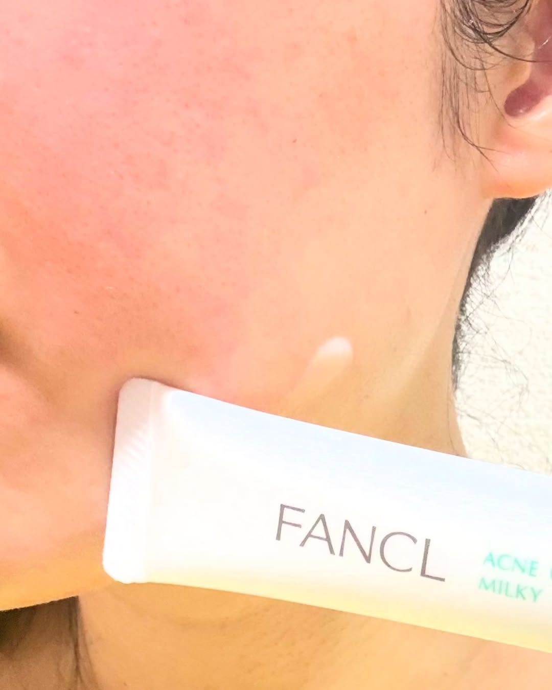 口コミ投稿：【FANCL アクネケア 化粧液、ジェル乳液、エッセンス】お気に入りのファンケルのアク…