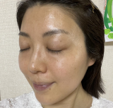 「シミのない肌になりたい！」の画像（1枚目）