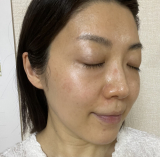 「シミのない肌になりたい！」の画像（2枚目）