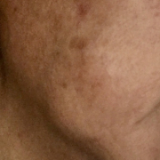 71歳です