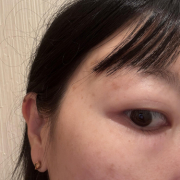 一度焼いたシミが復活しました