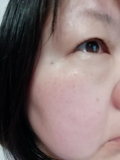 「頬のしみ」の画像（2枚目）