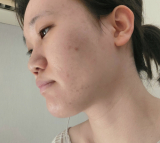 肌悩み