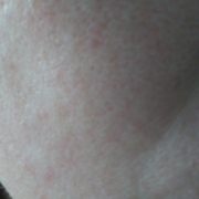 「気になる部分」シミキールナイトバームの”発売前先行モニター”募集♡の投稿画像