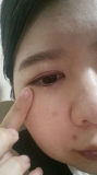 濃いシミ部分です。