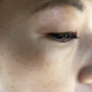 「シミが増えてきました」シミキールナイトバームの”発売前先行モニター”募集♡の投稿画像