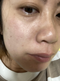 鼻周りの毛穴