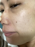 「鼻周りの毛穴」の画像（2枚目）