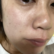 「鼻周りの毛穴」シミキールナイトバームの”発売前先行モニター”募集♡の投稿画像