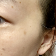 「目元のシミに悩み中」シミキールナイトバームの”発売前先行モニター”募集♡の投稿画像