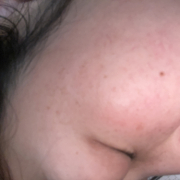 「しみとたるみが気になる」シミキールナイトバームの”発売前先行モニター”募集♡の投稿画像