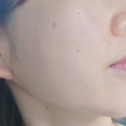 「頬のシミ、毛穴、気になります。」シミキールナイトバームの”発売前先行モニター”募集♡の投稿画像