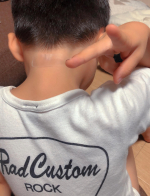 🩹🤕息子が虫に刺されて掻いてかさぶたになってまた掻いて…お水遊びやお風呂で水に触れるとヒリヒリする…😢というので、新型ばんそうこうを貼ってあげました✌️キズの痛みをやわらげ、早くきれいに治す…のInstagram画像