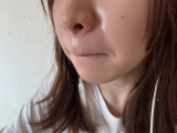 「色むら、小じわ、毛穴、乾燥が気になります！」の画像（2枚目）