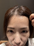 おでこのテカリ