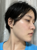 「顔左右、気になっている部分」の画像（2枚目）