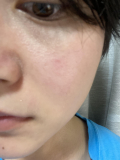 「顔左右、気になっている部分」の画像（3枚目）