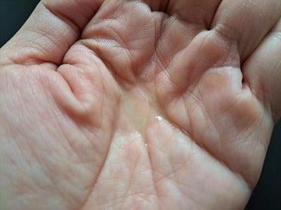 口コミ：オーロラスカルプ エッセンス(頭皮美容液)の画像（4枚目）