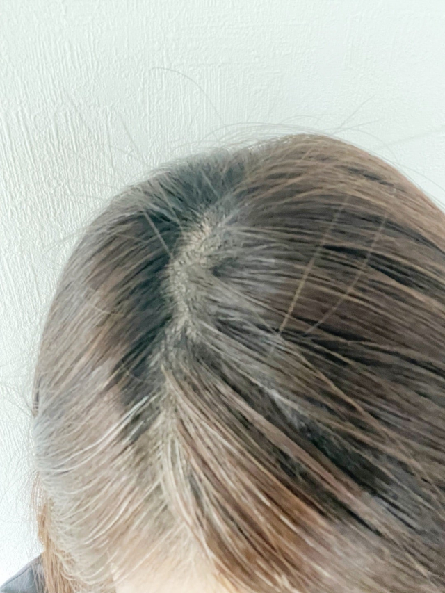 口コミ：オーロラスカルプエッセンスの画像（2枚目）