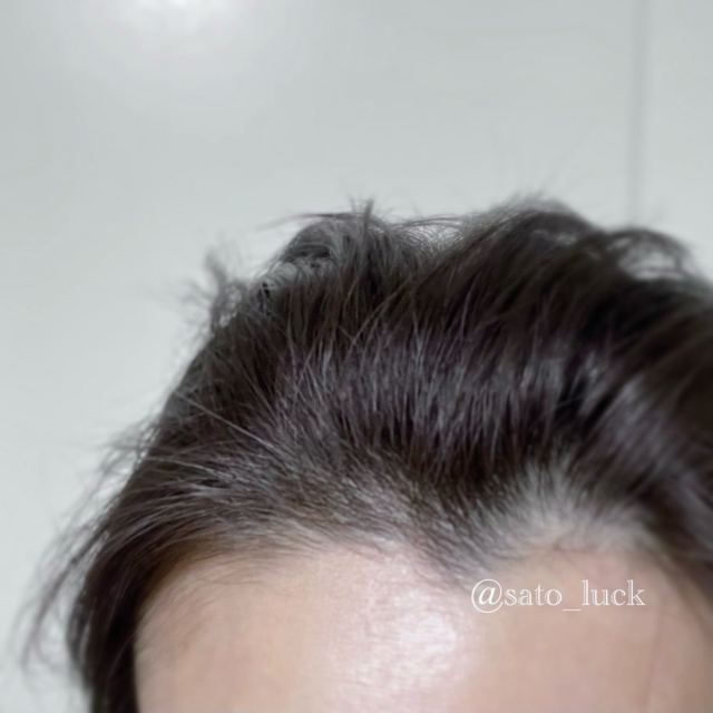 口コミ：育毛×黒髪のWケア　理想の黒ツヤ髪への画像（7枚目）
