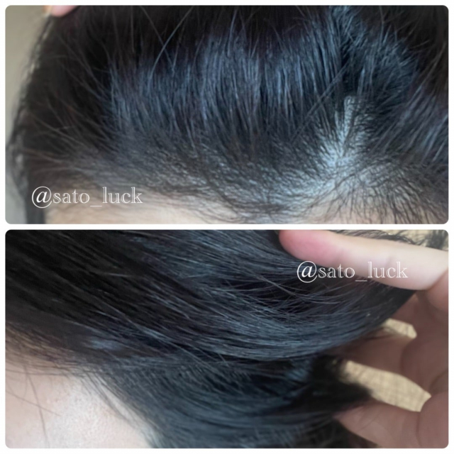 口コミ：育毛×黒髪のWケア　理想の黒ツヤ髪への画像（8枚目）