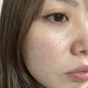 「肌悩み」【先行モニター】”発売前先行モニター”募集♡の投稿画像