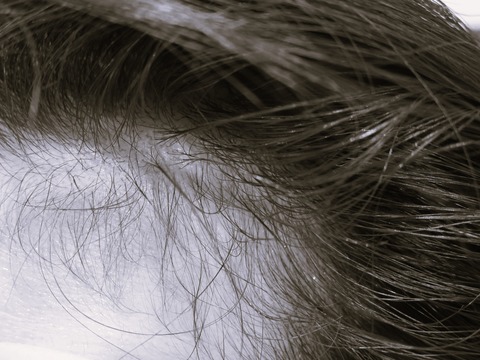 口コミ：オーロラスカルプローションの画像（2枚目）