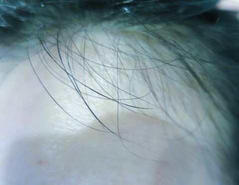 口コミ：オーロラ　スカルプローションの画像（2枚目）