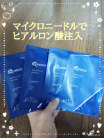 1回あたり約3,800本のマイクロニードルでヒアルロン酸注入できるクオニス ダーマフィラープレミアを週に１度ｘ計４回使ってみました！目の下のたるみ、しわ、クマが気になっていてアイクリームでは効果&hellip;のInstagram画像