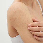 みんなのひとこと 腕のぶつぶつ ザラザラをスクラブで解消したいモニター５名募集 飲むだけじゃないコーヒー美容術 Coffee Scrub Sass 1ページ