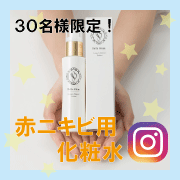 ニキビケア用化粧水 メークで隠れない赤ニキビへアプローチ 305 ニキビ跡ケア スキンケア あいび のファンサイト モニプラ